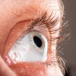 Keratokonus, Gangguan Mata Menyebabkan Kornea Jadi Menonjol